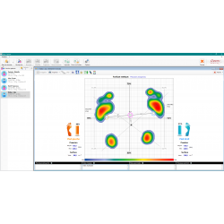 Plateforme de marche baropodométrique EASY-CAPTEUR 120x50 cm pour analyse dynamique et posturologie clinique