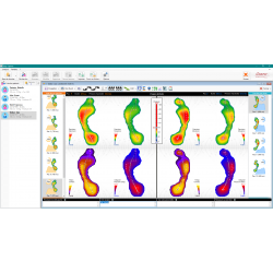Plateforme de marche baropodométrique EASY-CAPTEUR 120x50 cm pour analyse dynamique et posturologie clinique